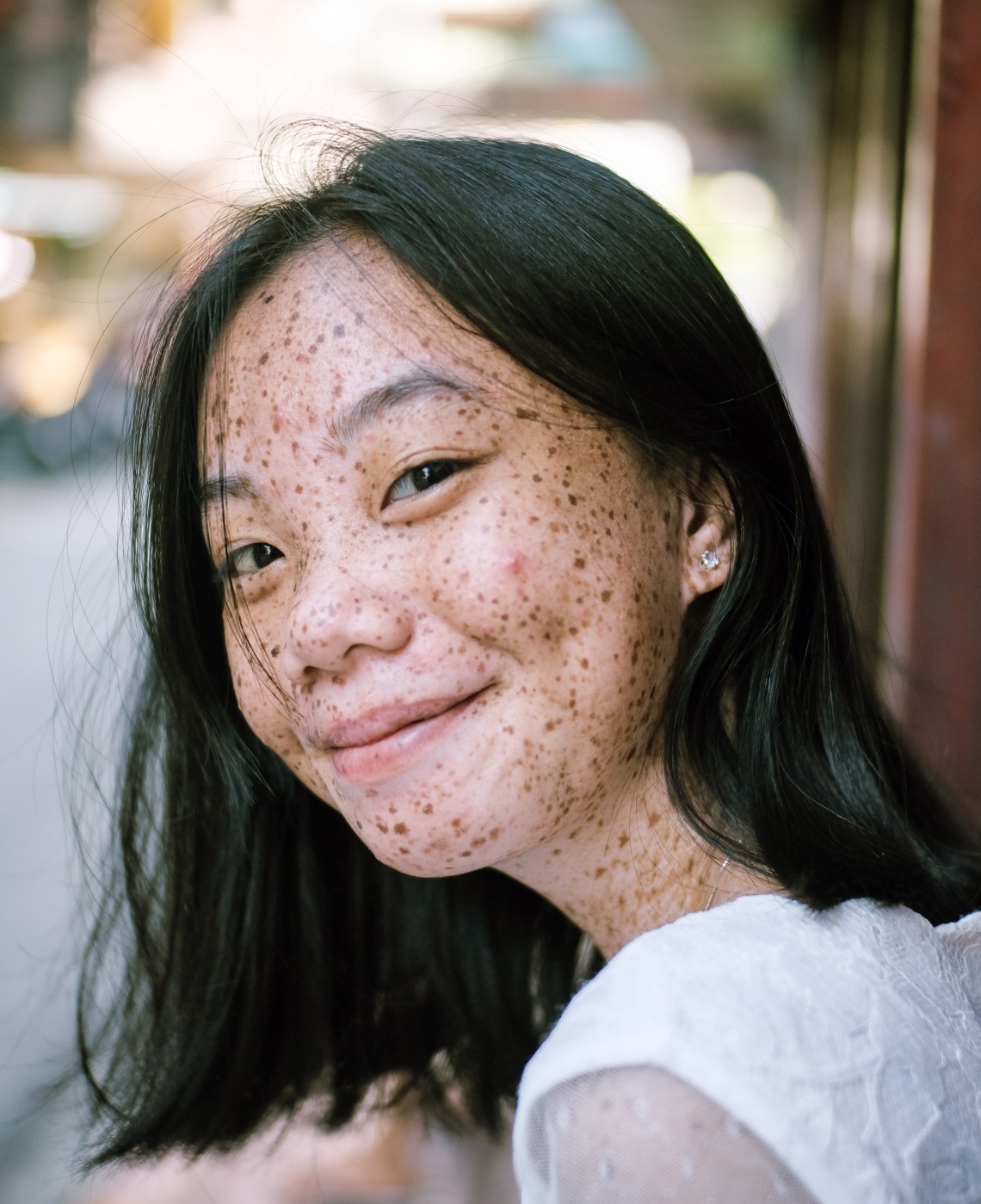 person with freckles smiling